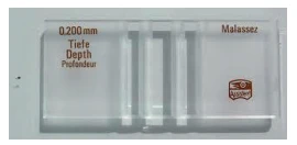 Cellule de Malassez